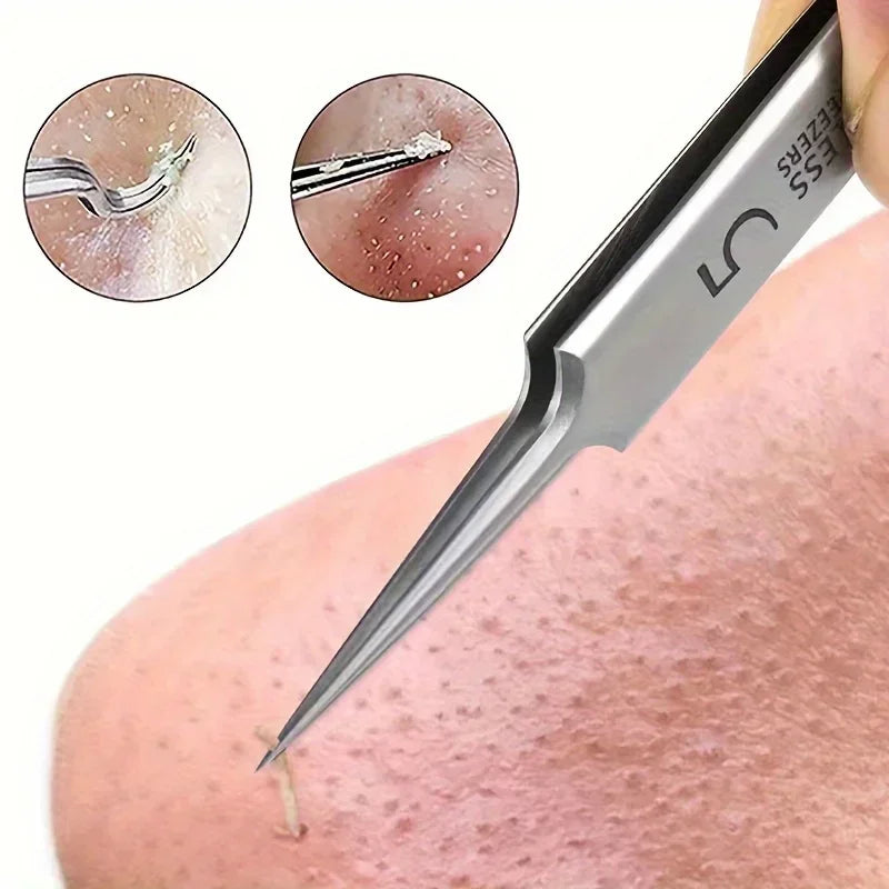 Facial Beauty Remove Acne Needle Tools for Skin Care