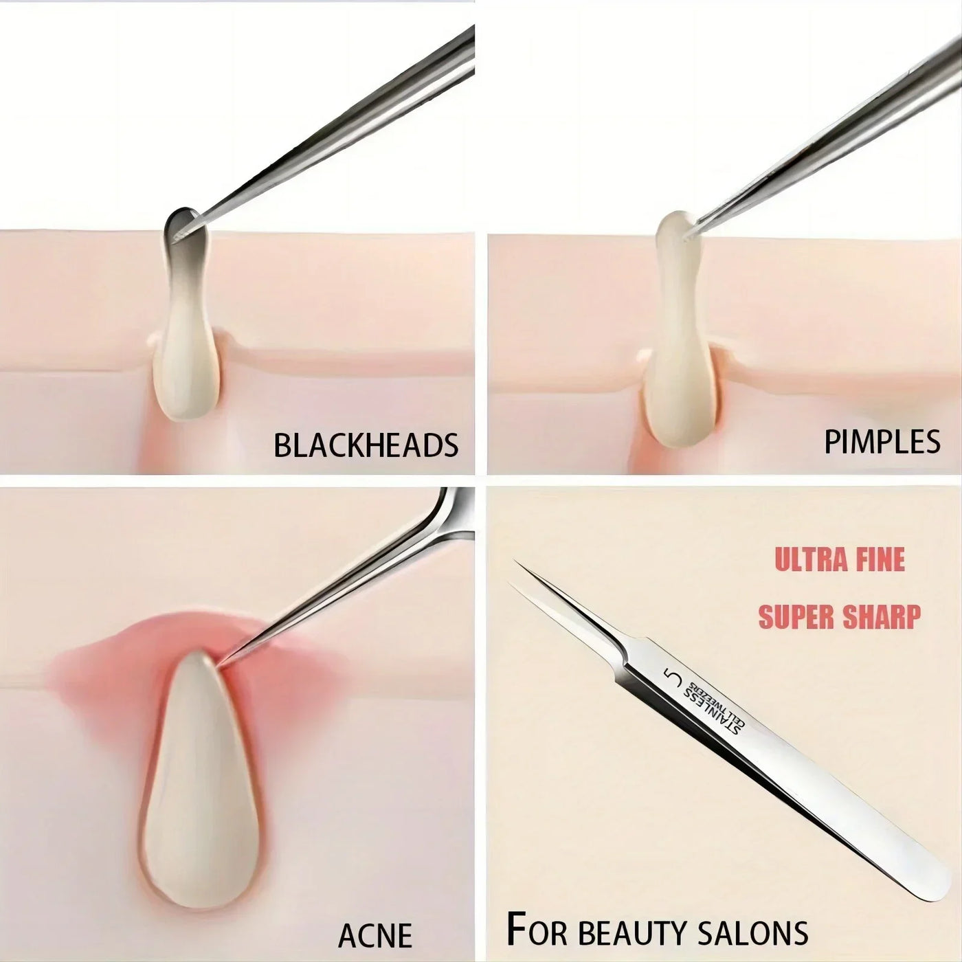 Facial Beauty Remove Acne Needle Tools for Skin Care