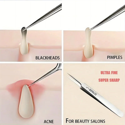 Facial Beauty Remove Acne Needle Tools for Skin Care