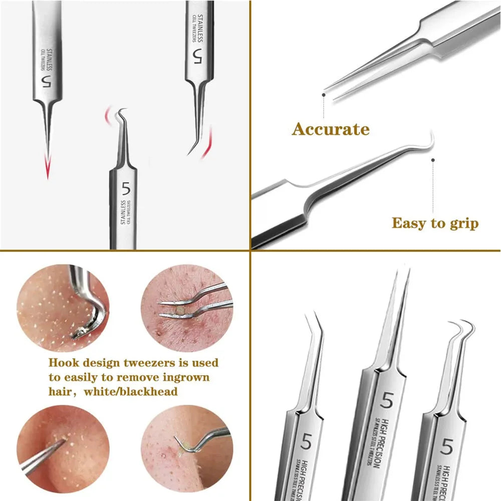 German Ultra-fine No. 5 Cell Pimples Blackhead Clip