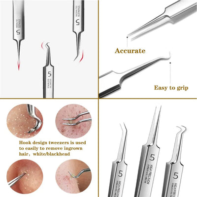 German Ultra-fine No. 5 Cell Pimples Blackhead Clip