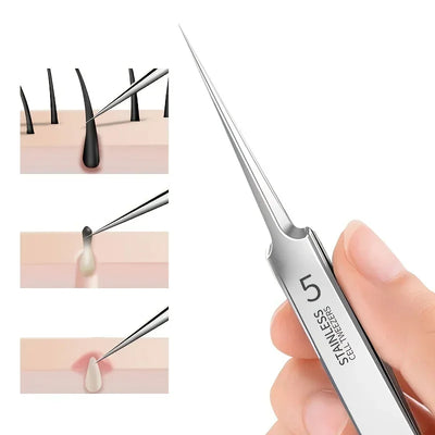 Facial Beauty Remove Acne Needle Tools for Skin Care
